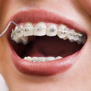 ortodontia-home